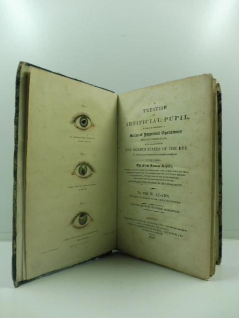 A treatise on artificial pupil in which is described a series of improved operations for its formation whith an account of the morbid states of the eye to which such operations are aplicable to this is added the first annual report detailing the case of all the pensioners, who, during... By Sir W. Adams ophtalmic surgeon to the above institution